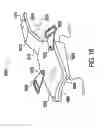Fig. 19 - ORTHOTIC BRACE