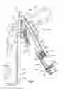 Fig. 06 - Shoulder orthosis