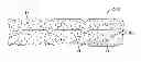 Fig. 01 - Clay-based hemostatic agents and devices for the delivery thereof