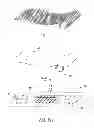 Fig. 03 - Clay-based hemostatic agents and devices for the delivery thereof