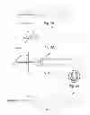 Fig. 05 - TROCAR AND TROCAR-NEEDLE INTEGRATED SYSTEM FOR GLAUCOMA DRAINAGE SURGERY