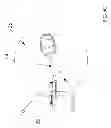 Fig. 08 - TROCAR AND TROCAR-NEEDLE INTEGRATED SYSTEM FOR GLAUCOMA DRAINAGE SURGERY