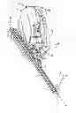 Fig. 03 - Hemostasis valve for guide catheter control