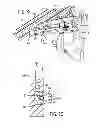Fig. 07 - Hemostasis valve for guide catheter control