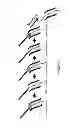 Fig. 02 - Catheter system providing step reduction for postconditioning
