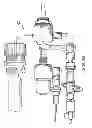 Fig. 05 - Catheter system providing step reduction for postconditioning