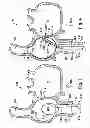 Fig. 03 - APPARATUS AND METHOD FOR TARGETING A BODY TISSUE
