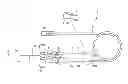 Fig. 01 - INDWELLING NEEDLE ASSEMBLY