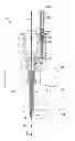 Fig. 16 - INDWELLING NEEDLE ASSEMBLY