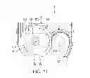 Fig. 22 - INDWELLING NEEDLE ASSEMBLY