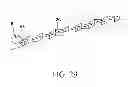Fig. 30 - INDWELLING NEEDLE ASSEMBLY