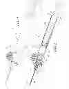 Fig. 02 - Frontal attachment device for syringe with rotationally activated retractable needle