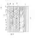 Fig. 04 - Drug delivery device