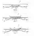 Fig. 03 - Hemostatic agent and method