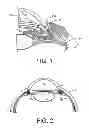 Fig. 02 - Drug delivery devices and methods