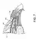 Fig. 12 - Drug delivery devices and methods