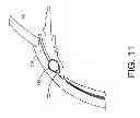 Fig. 19 - Drug delivery devices and methods