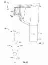 Fig. 04 - Systems and methods for anchoring medical devices