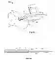 Fig. 06 - Systems and methods for anchoring medical devices