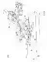 Fig. 08 - Systems and methods for anchoring medical devices