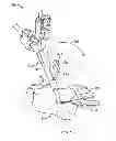 Fig. 12 - Systems and methods for anchoring medical devices