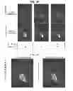 Fig. 19 - Systems and methods for reducing or preventing backflow in a delivery system