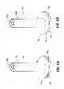 Fig. 12 - Disposable pen needle with re-use prevention features