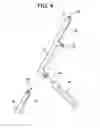 Fig. 05 - System for access into bodily cavity