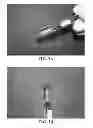 Fig. 04 - Liquid embolic material including carboxymethyl chitosan crosslinked with carboxymethyl cellulose