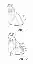 Fig. 02 - Intra-Myocardial Agent Delivery Device, System and Method