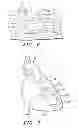 Fig. 04 - Intra-Myocardial Agent Delivery Device, System and Method