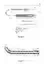 Fig. 02 - Treatment fluid delivery method, and turbulator for promoting uptake of a treatment agent