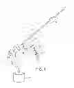 Fig. 02 - Apparatus and methods for clot dissolution