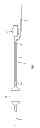 Fig. 02 - Catheter with adjustable guidewire exit position