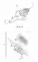 Fig. 08 - Catheter Valve and Methods of Using Same