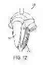 Fig. 09 - Catheter Valve and Methods of Using Same
