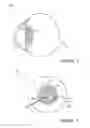 Fig. 04 - CORNEAL MULTI-PLANE INCISION USING A SURGICAL LASER SETUP CALCULATIONS INTERFACE