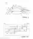 Fig. 06 - CORNEAL MULTI-PLANE INCISION USING A SURGICAL LASER SETUP CALCULATIONS INTERFACE