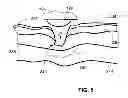 Fig. 06 - Disposable electromagnetic energy applicator