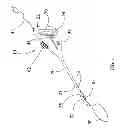 Fig. 02 - Resecting Device