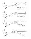 Fig. 14 - Resecting Device