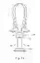 Fig. 22 - Apparatus and methods for fixating a cranial bone flap with a cranial bone mass