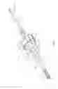 Fig. 02 - Surgical instrument and method