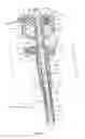 Fig. 04 - Surgical instrument and method