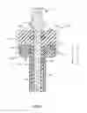 Fig. 07 - Surgical instrument and method