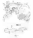 Fig. 07 - External tibial mill guide and method of use