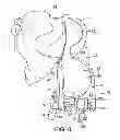 Fig. 08 - External tibial mill guide and method of use