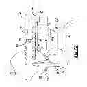 Fig. 09 - Method and apparatus for performing knee arthroplasty