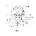 Fig. 02 - Pedicle depth measuring apparatus