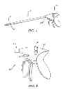 Fig. 02 - Circular needle applier with articulating and rotating shaft